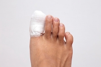 Causes of a Broken Toe