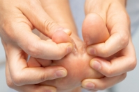 Recognizing the Symptoms of Athlete's Foot