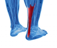 What an Achilles Tendon Injury May Feel Like